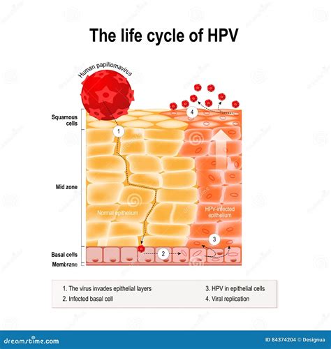 Life cycle of hpv stock vector. Illustration of papillomatosis - 84374204