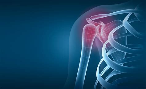 Shoulder Arthritis - Orthopedic AssociatesBlog | Denver Top Surgeons ...