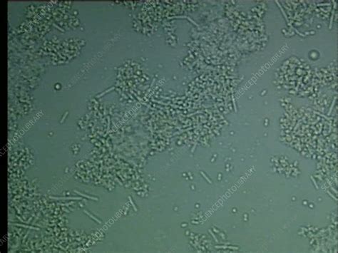 Lactobacillus bulgaricus bacteria, microscopy - Stock Video Clip - K009 ...