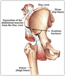 HIP - First Health PT