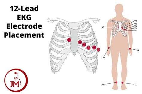 [DIAGRAM] 15 Lead Ekg Placement Diagram - MYDIAGRAM.ONLINE