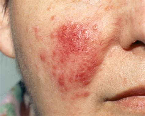 Skin Rash: 7 Causes of Red Spots and Bumps With Pictures | Allure