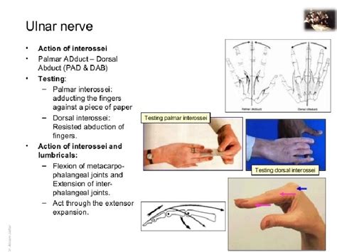 ULNAR NERVE ANATOMY Its LESIONS Dr Mukesh Singla