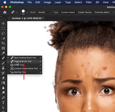 How to Clear Pimples in Photoshop: A Comprehensive Beginner’s Guide