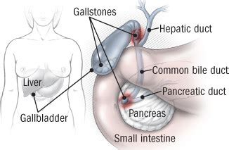 Bile Duct Diseases - Harvard Health