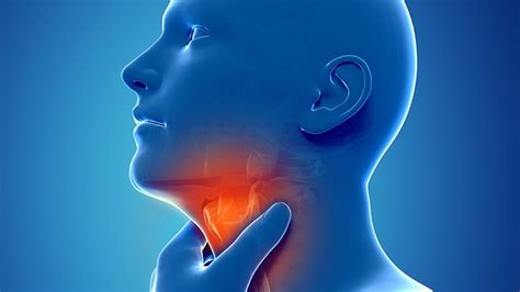 Could Your Sore Throat Be Caused by 'Silent Reflux'? | Everyday Health