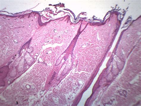 Hair Follicle - Prepared Microscope Slide - 75x25mm — Eisco Labs