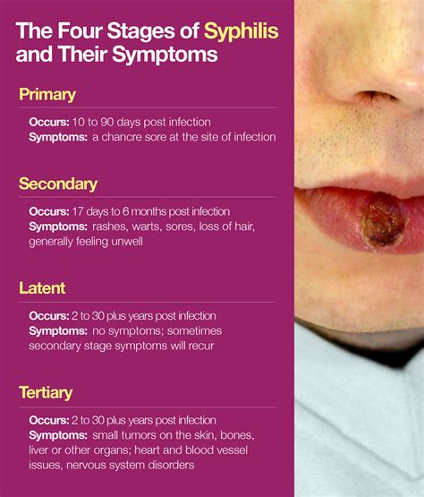 Syphilis Diagram