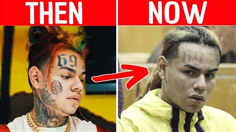 Rapper 6IX9INE Has TATTOOS REMOVED After Joining Witness Protection ...