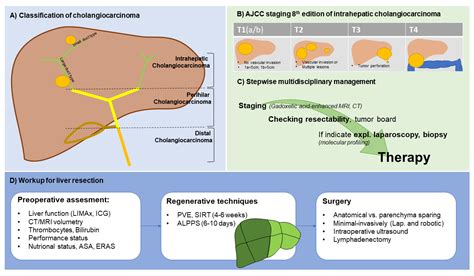 Cancers | Free Full-Text | Treatment of Intrahepatic Cholangiocarcinoma ...