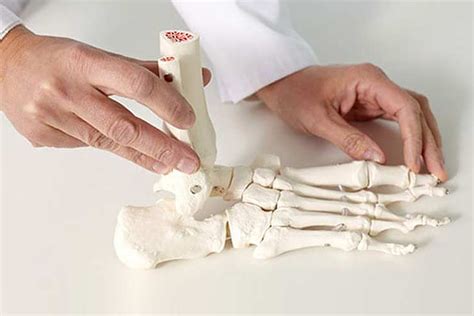 Sesamoid Foot Injury & Treatment | The Foot Practice Singapore