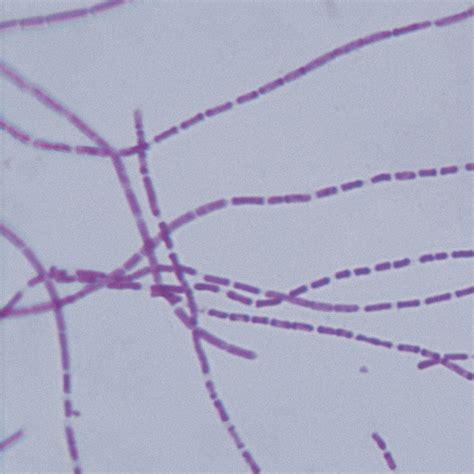 Bacillus anthracis Microscope Slides | Carolina Biological Supply