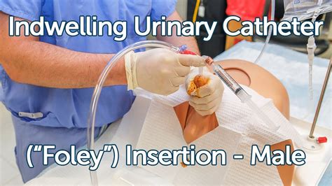 Indwelling Urinary Catheter (Foley) Insertion - Male - YouTube