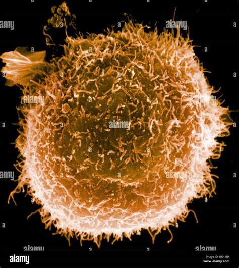 Scanning electron microscope image of a human macrophage Stock Photo ...