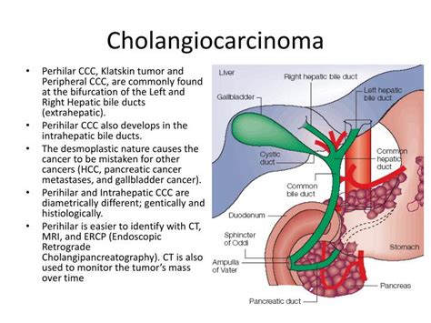 PPT - Monitoring Cholangiocarcinoma with F18-FDG PET/CT imaging ...