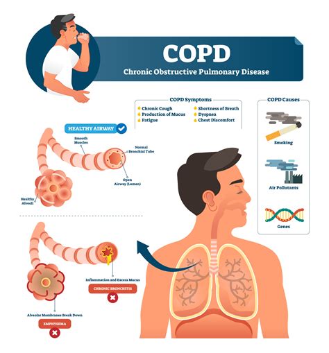 COPD - Respiratory Medical