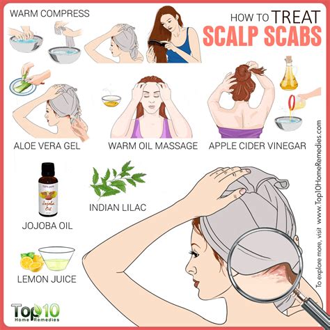 How to Treat Scalp Scabs | Top 10 Home Remedies