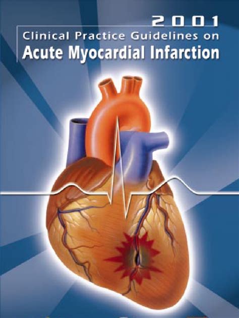 Acute Myocardial Infarction | PDF | Coronary Artery Disease ...