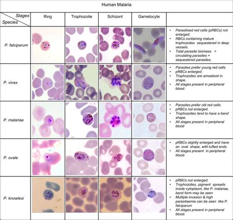 Five Different Human Malaria Plasmodium Species And Their Life Stages ...