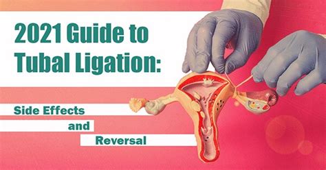 Tubal Ligation: What It Is, Side Effects, Reversal, and Risks