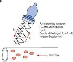 Image result for doppler equation ultrasound | Ultrasound, Ultrasound ...