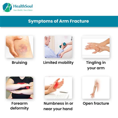 Arm Fracture: Causes and Treatment – Healthsoul