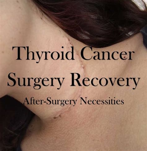 Thyroid Cancer Surgery Recovery – After-Surgery Necessities