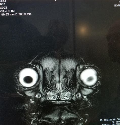 Pug MRI : oddlyterrifying