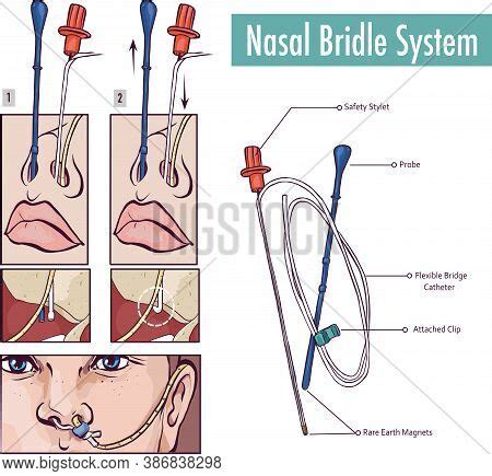 Nasal Bridle Vector & Photo (Free Trial) | Bigstock