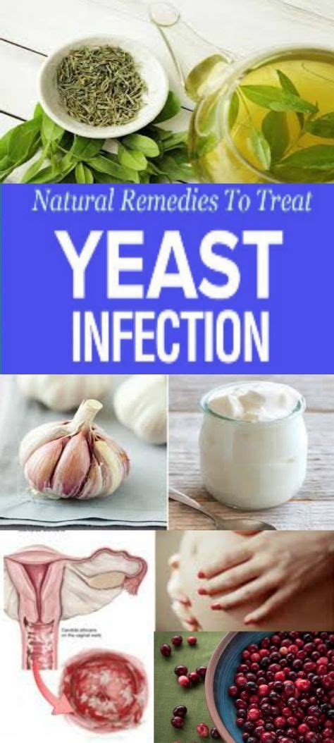 Natural Remedies To Treat Yeast Infection (With images) | Treat yeast ...