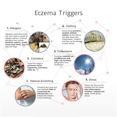 Interesting Facts about Atopic Dermatitis - Eczema Infographic