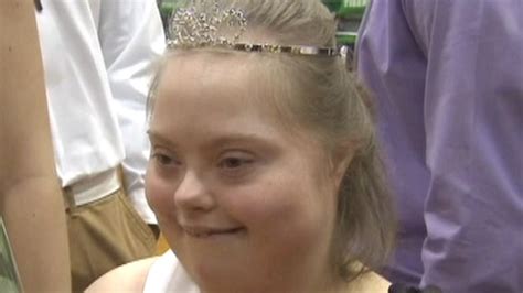 Student with down syndrome elected homecoming queen| Latest News Videos ...