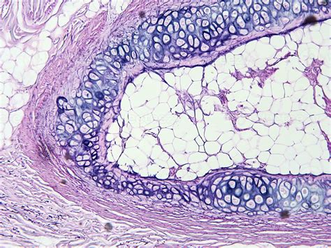 histology human tissue with microscope from laboratory 27222639 Stock ...