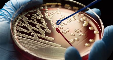 Microbiology, PhD - Find Your Degree