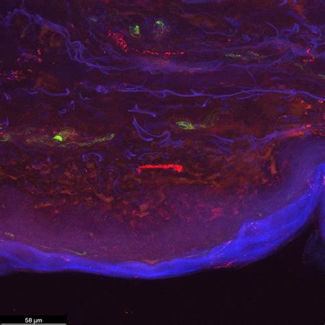 What could improve my small nerve fiber staining? | ResearchGate