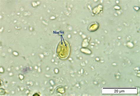 Giardia Cysts