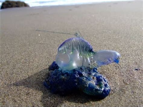 BLUEBOTTLE JELLYFISH STING - YouTube