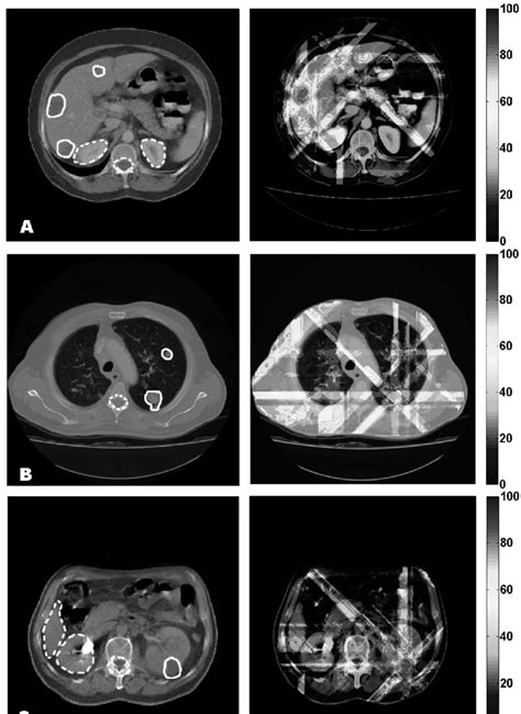 Computed tomography images used in the simulations. The detached ...