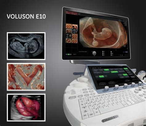 GE Voluson E10 | Probo Medical