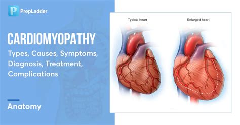 Cardiomyopathy : Types, Causes, Symptoms and Treatment