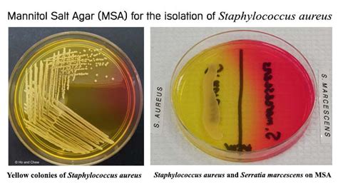 Mannitol Salt Agar for the isolation of Staphylococcus aureus