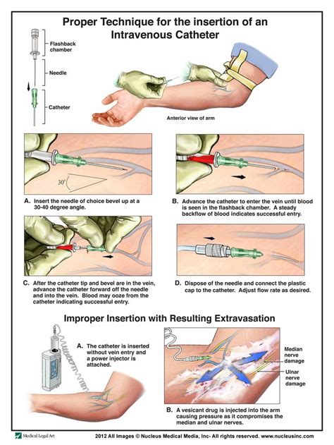 78 best Injections images on Pinterest | Nursing students, Student ...