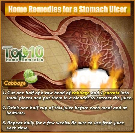 Home Remedies for a Stomach Ulcer | Top 10 Home Remedies