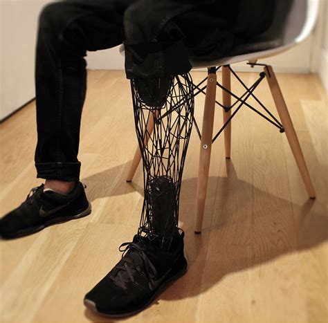 3D printed exo-prosthetic leg becomes a customizable body part