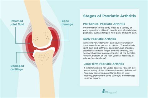 Psoriatic Arthritis Elbow