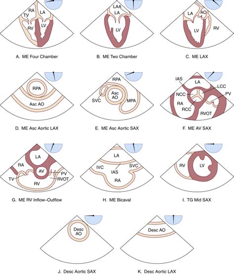 Focused Transesophageal Echocardiography | Radiology Key