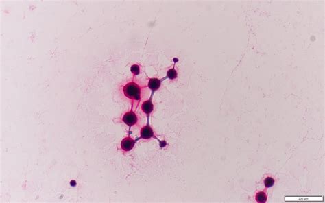 Cryptococcus neoformans〔クリプトコッカス〕 | グラム染色: Gram Stain