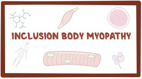 Inclusion body myopathy: Video, Anatomy & Definition | Osmosis