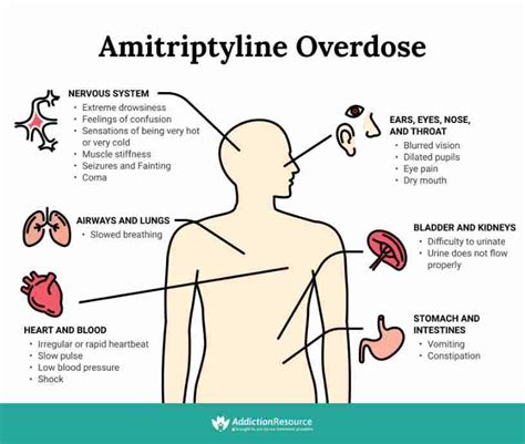 Amitriptyline Overdose: Symptoms And Treatment | Infographics Archive