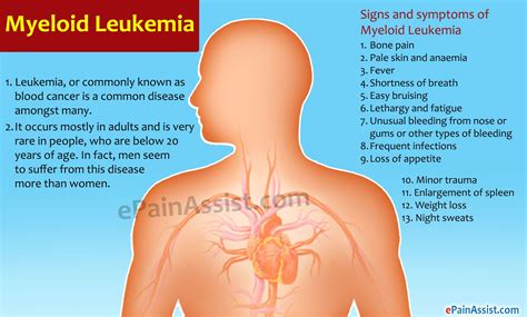 LEUKEMIA: CAUSES , SYMPTOMS, AND TREATMENT